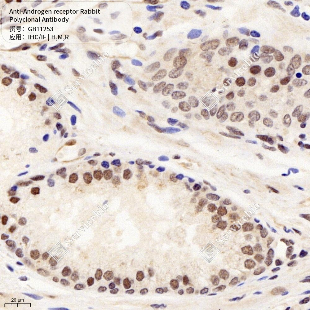 Антитела первичные, поликлональные кролика к Androgen receptor крысы, мыши, человека, 100 мкл