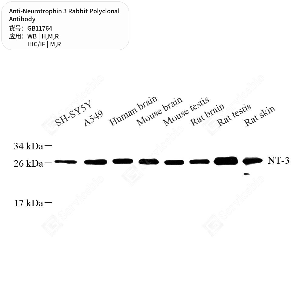 Антитела первичные, поликлональные кролика к Neurotrophin 3 крысы, мыши, человека, 50 мкл
