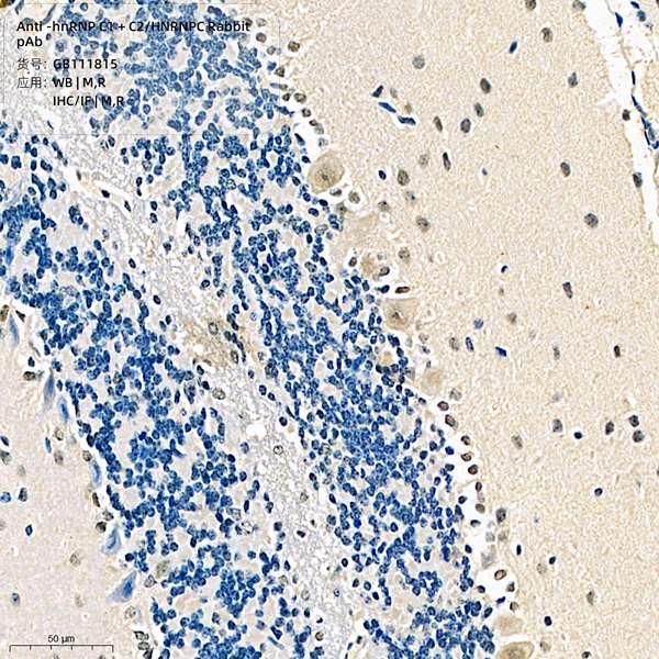 Антитела первичные, поликлональные, hnRNP C1 + C2/HNRNPC, 100 мкл