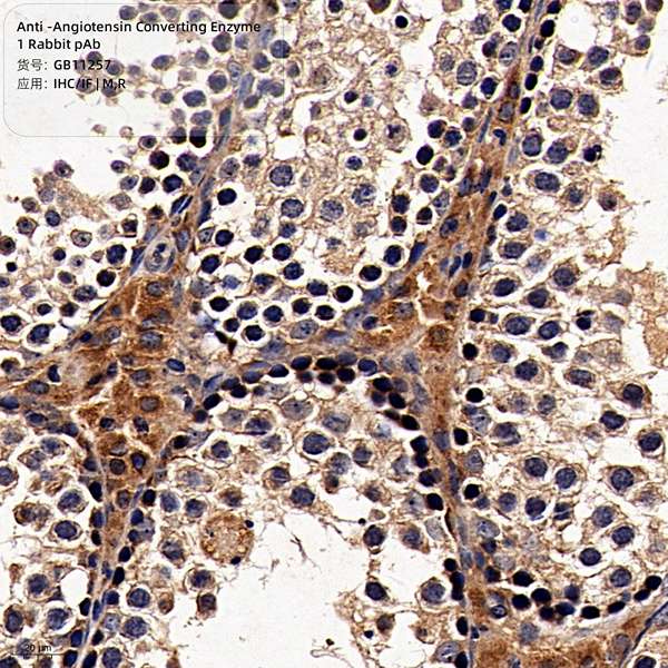 Антитела первичные, поликлональные, Angiotensin Converting Enzyme 1, 100 мкл