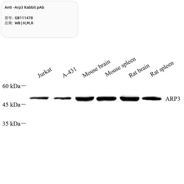 Антитела первичные, поликлональные, Arp3, 100 мкл