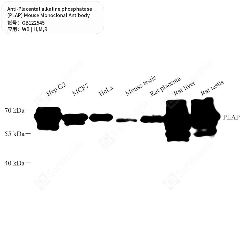Антитела первичные, монок. мыши к Placental alkaline phosphatase (PLAP) крысы, мыши, чел., 50 мкл