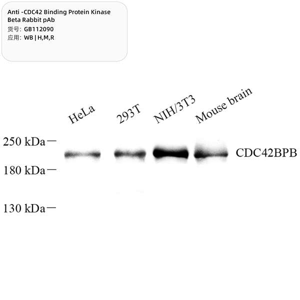Антитела первичные, поликлональные, CDC42 Binding Protein Kinase Beta, 100 мкл