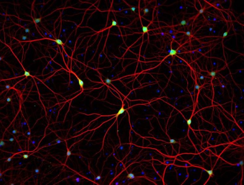 Антитела вторичные, поликлональные IgG (H+L), конъюгированные Alexa Fluor 594, 1 мг