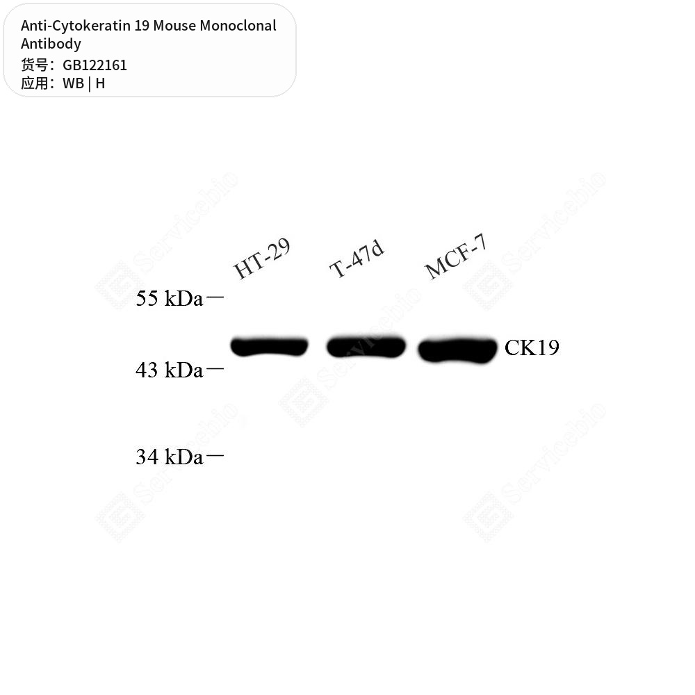 Антитела первичные, моноклональные мыши к Cytokeratin 19 человека, 50 мкл