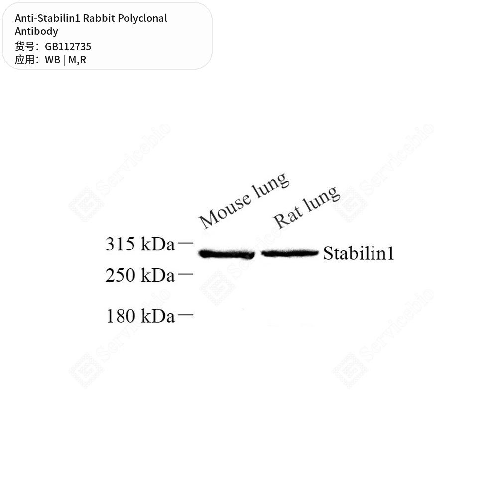 Антитела первичные, поликлональные кролика к Stabilin1 крысы, мыши, 100 мкл