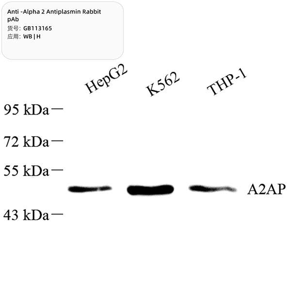 Антитела первичные, поликлональные, alpha 2 Antiplasmin, 100 мкл