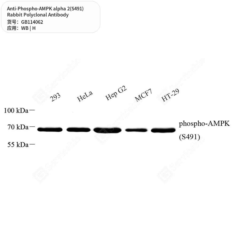 Антитела первичные, поликлональные кролика к Phospho-AMPK alpha 2(S491) человека, 50 мкл