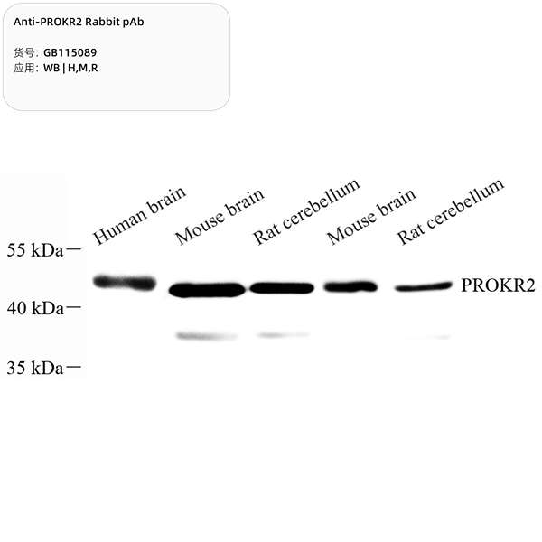 Антитела первичные, поликлональные, PROKR2, 100 мкл