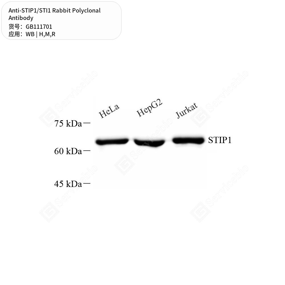 Антитела первичные, поликлональные кролика к STIP1/STI1 крысы, мыши, человека, 100 мкл