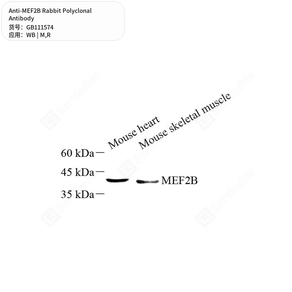 Антитела первичные, поликлональные кролика к MEF2B крысы, мыши, 100 мкл