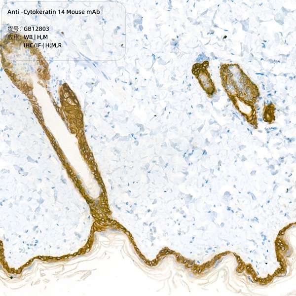 Антитела первичные, моноклональные, Cytokeratin 14, 100 мкл