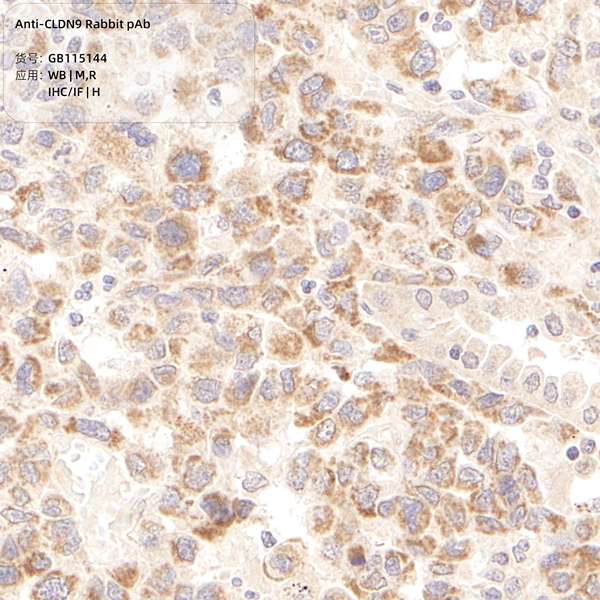 Антитела первичные, поликлональные, CLDN9, 100 мкл