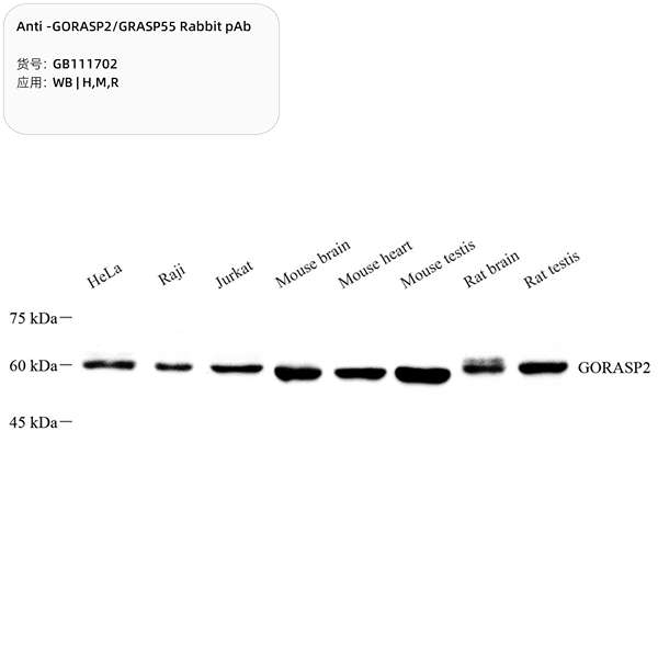 Антитела первичные, поликлональные, GORASP2/GRASP55, 100 мкл