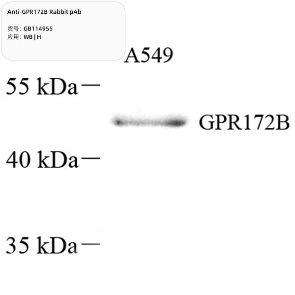 Антитела первичные, поликлональные, GPR172B, 100 мкл