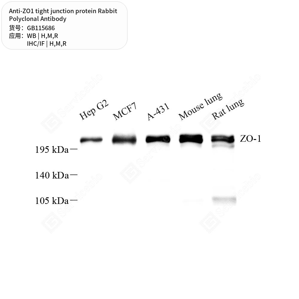Антитела первичные, поликл. кролика к ZO1 tight junction protein крысы, мыши, человека, 50 мкл