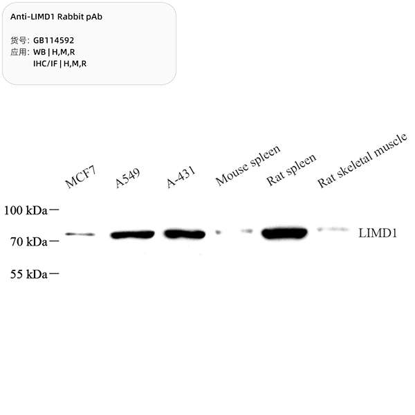 Антитела первичные, поликлональные, LIMD1, 100 мкл