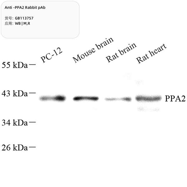 Антитела первичные, поликлональные, PPA2, 100 мкл
