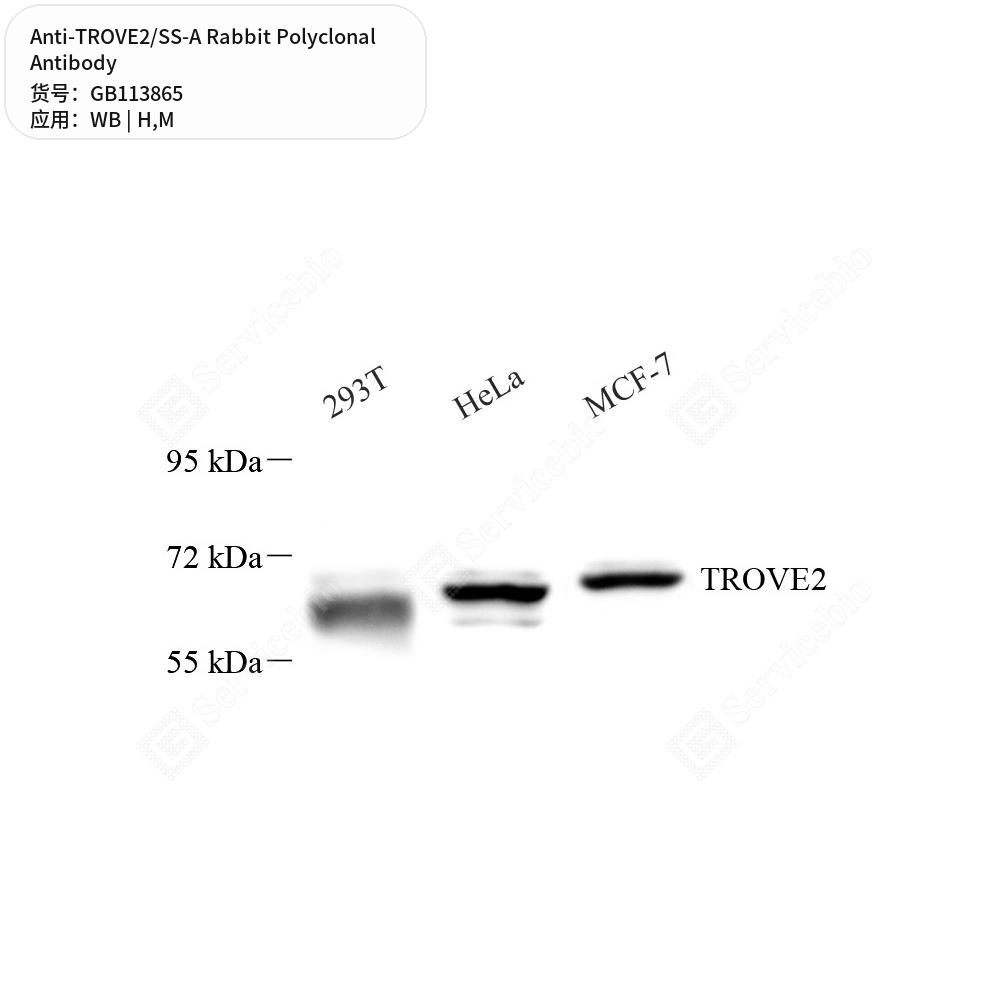 Антитела первичные, поликлональные кролика к TROVE2/SS-A мыши, человека, 50 мкл
