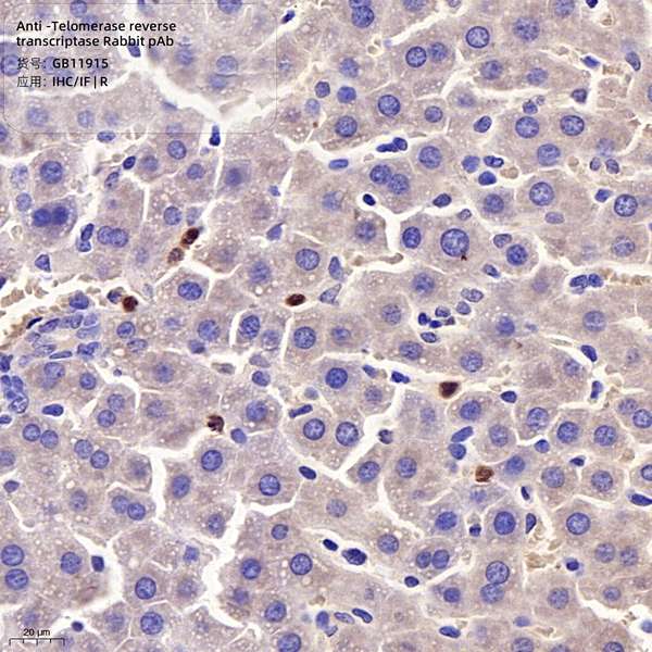 Антитела первичные, поликлональные, Telomerase reverse transcriptase, 100 мкл