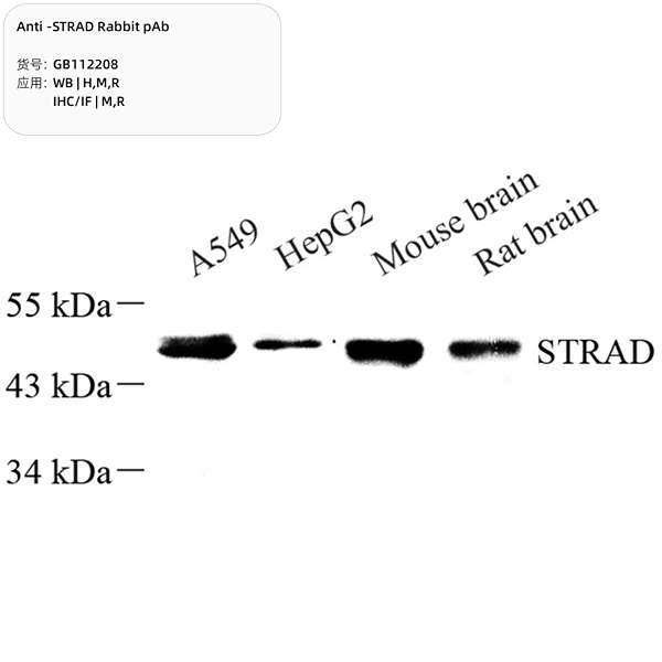 Антитела первичные, поликлональные, STRAD, 100 мкл