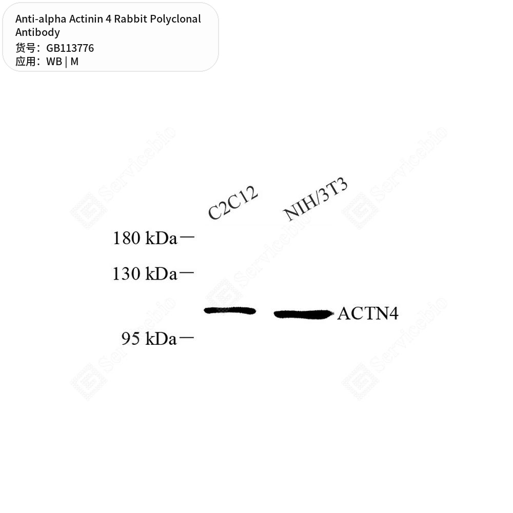 Антитела первичные, поликлональные кролика к alpha Actinin 4 мыши, 100 мкл