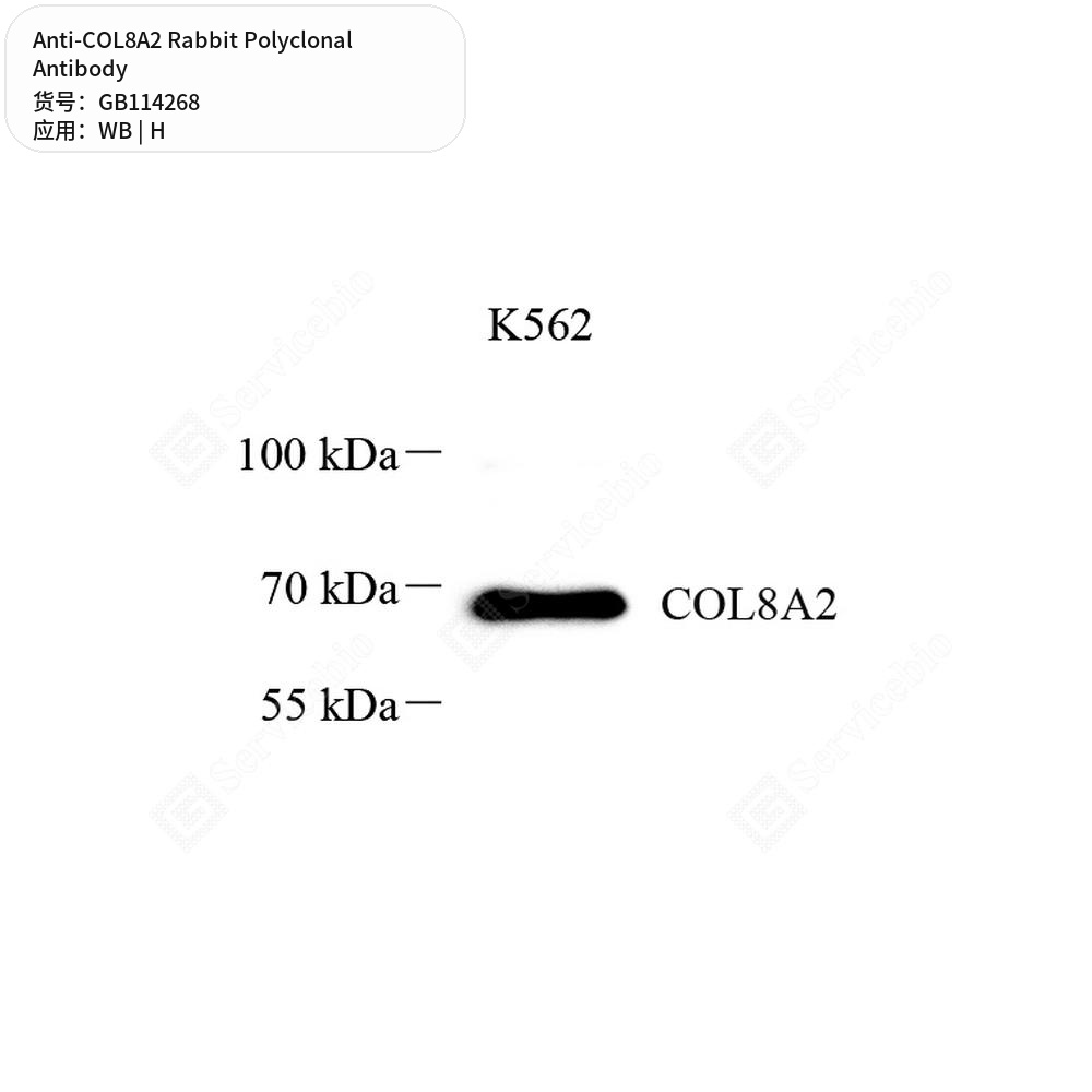 Антитела первичные, поликлональные кролика к COL8A2 человека, 100 мкл