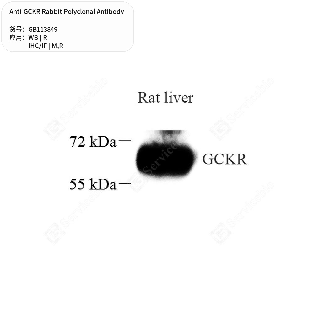 Антитела первичные, поликлональные кролика к GCKR крысы, мыши, 50 мкл