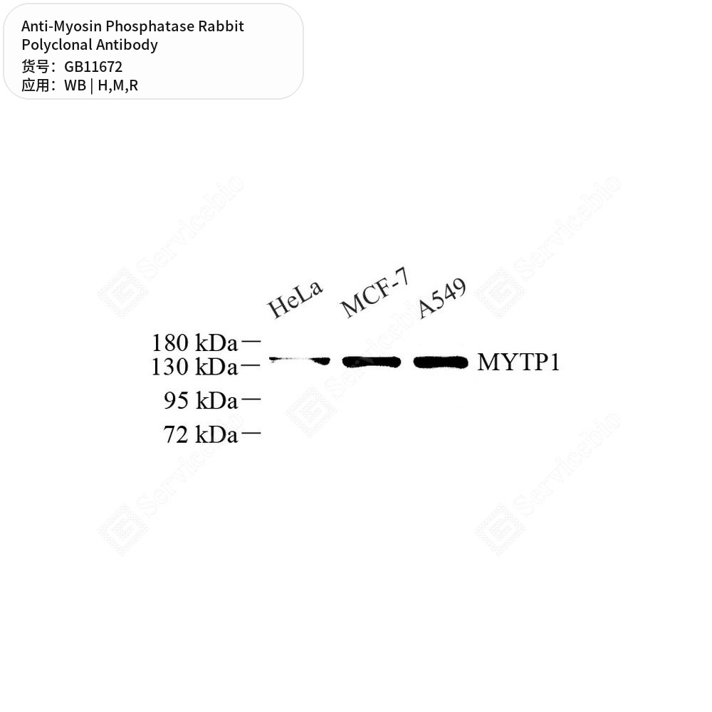Антитела первичные, поликлональные кролика к Myosin Phosphatase крысы, мыши, человека, 50 мкл