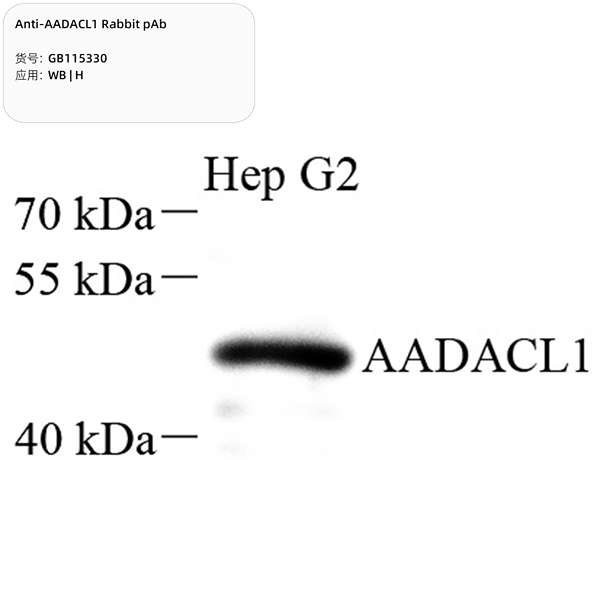 Антитела первичные, поликлональные, AADACL1, 100 мкл