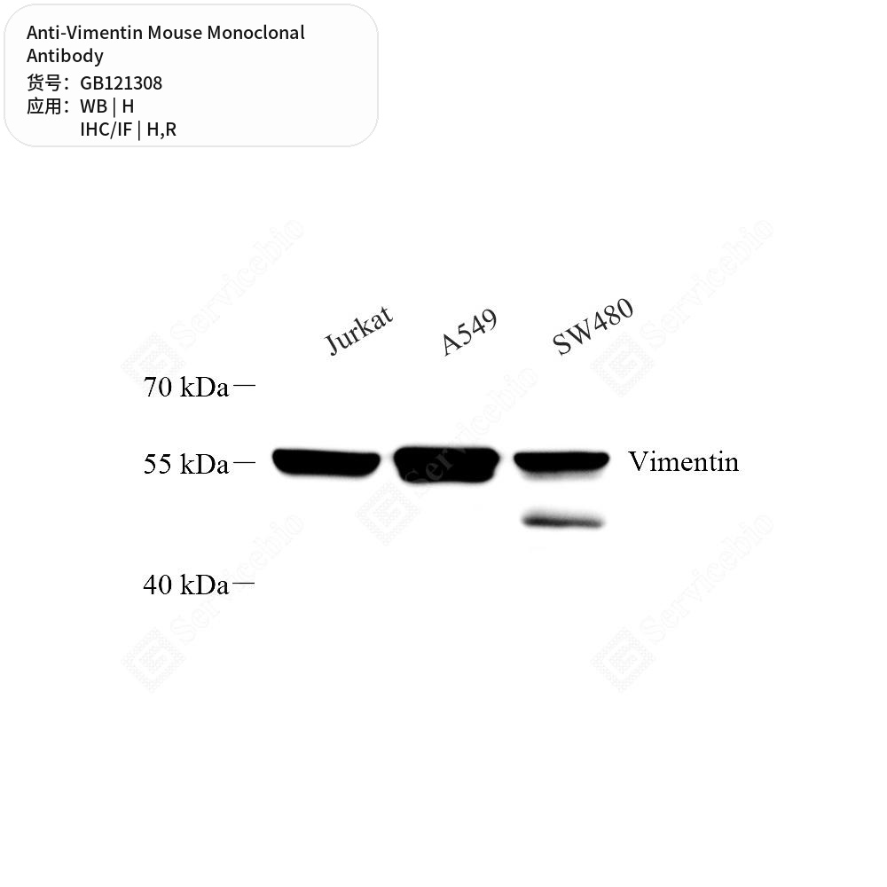 Антитела первичные, моноклональные мыши к Vimentin крысы, человека, 50 мкл
