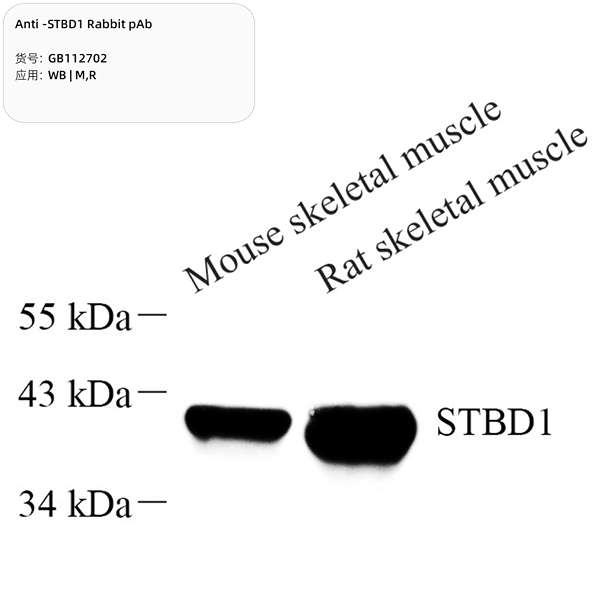 Антитела первичные, поликлональные, STBD1, 100 мкл