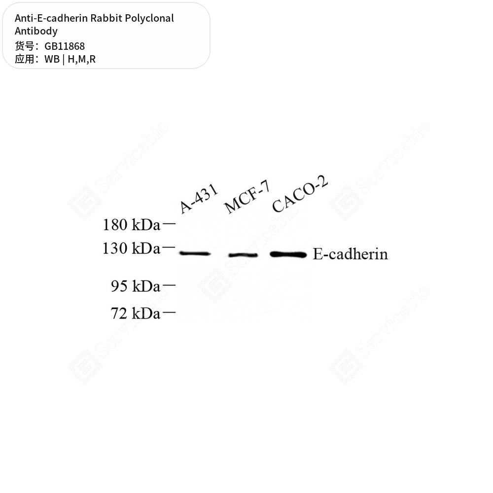 Антитела первичные, поликлональные кролика к E-cadherin крысы, мыши, человека, 50 мкл