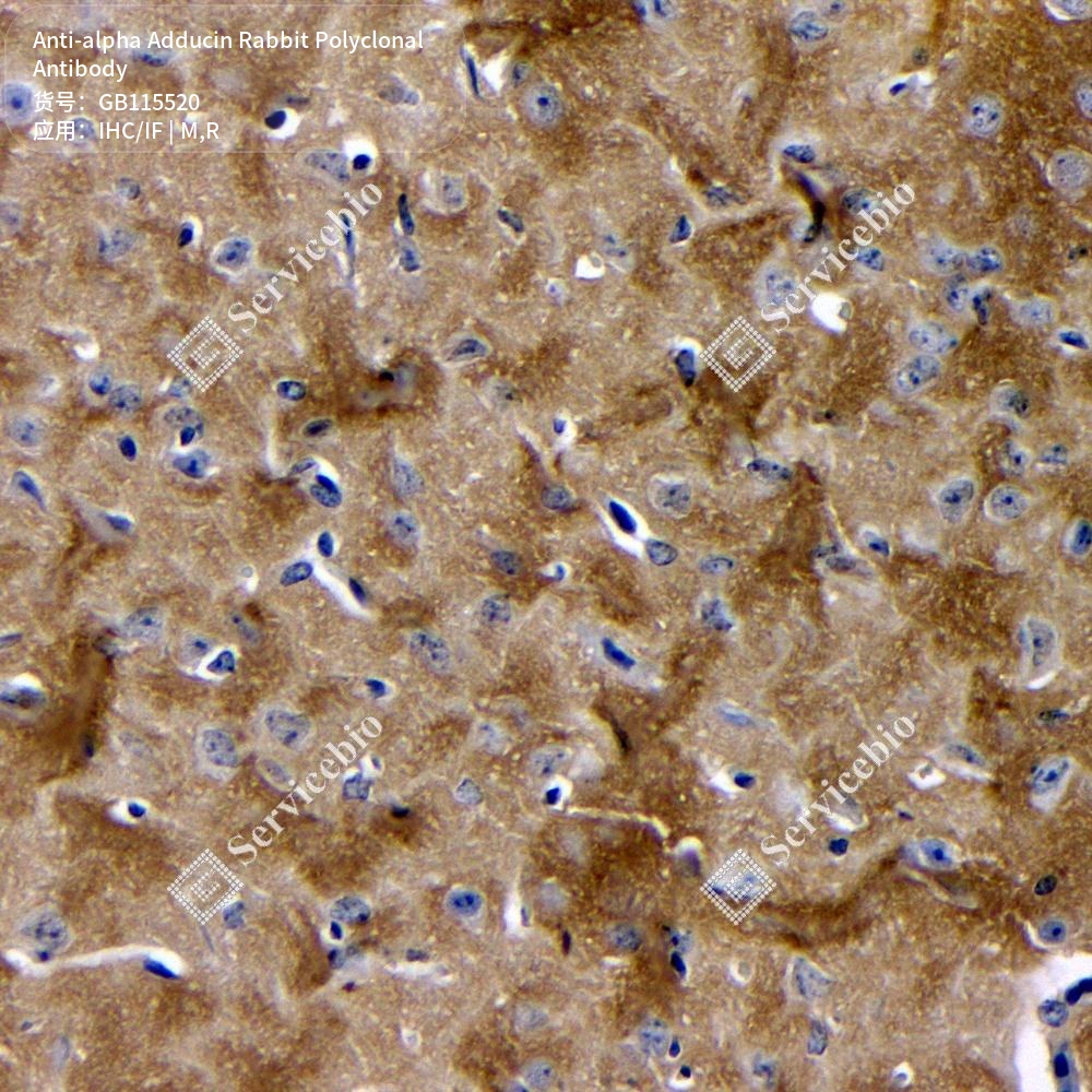 Антитела первичные, поликлональные кролика к alpha Adducin крысы, мыши, 100 мкл