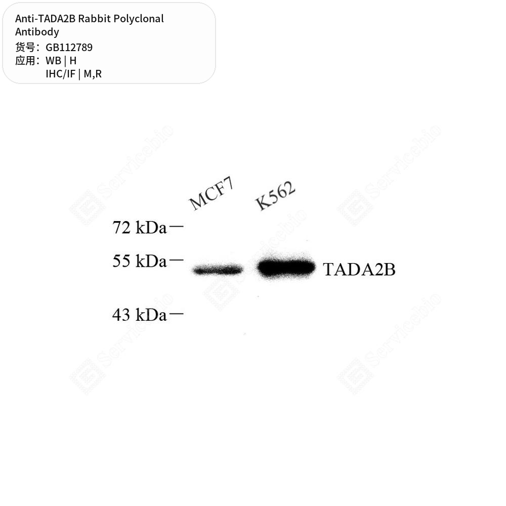 Антитела первичные, поликлональные кролика к TADA2B крысы, мыши, человека, 100 мкл