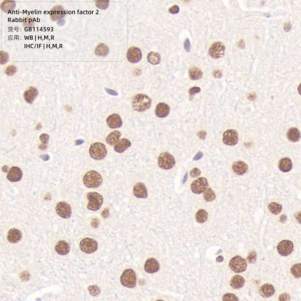 Антитела первичные, поликлональные, Myelin expression factor 2, 100 мкл
