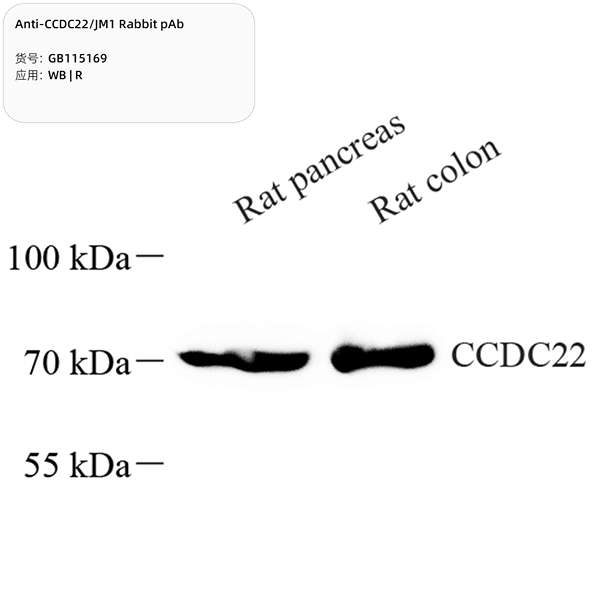 Антитела первичные, поликлональные, CCDC22/JM1, 100 мкл
