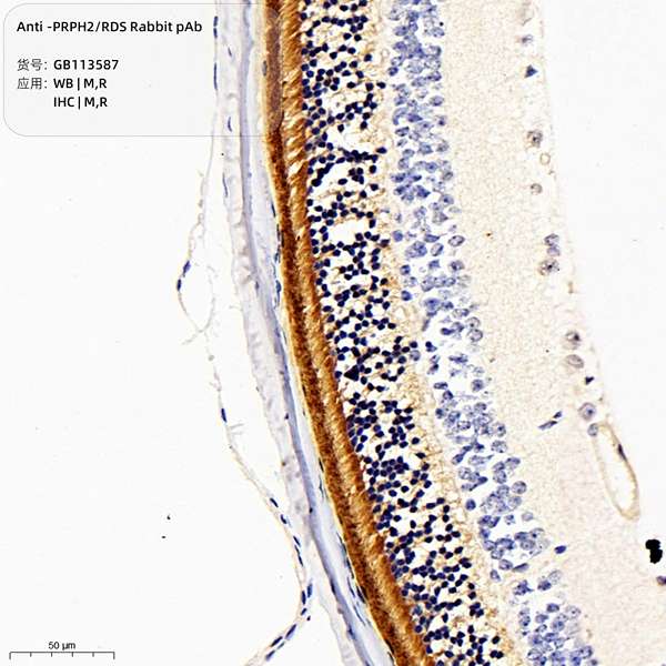 Антитела первичные, поликлональные, PRPH2/RDS, 100 мкл