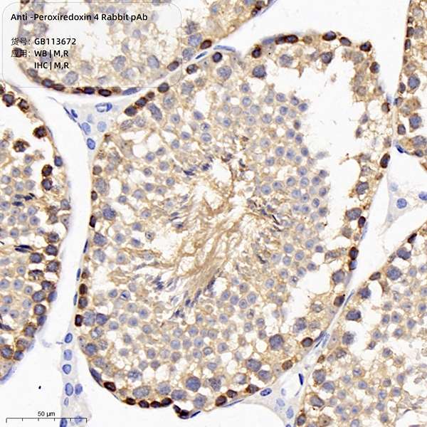 Антитела первичные, поликлональные, Peroxiredoxin 4, 100 мкл
