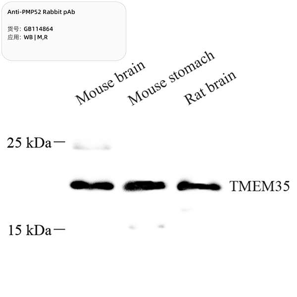 Антитела первичные, поликлональные, PMP52, 100 мкл