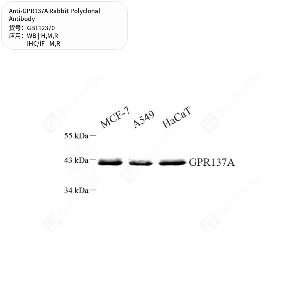 Антитела первичные, поликлональные кролика к GPR137A крысы, мыши, человека, 100 мкл