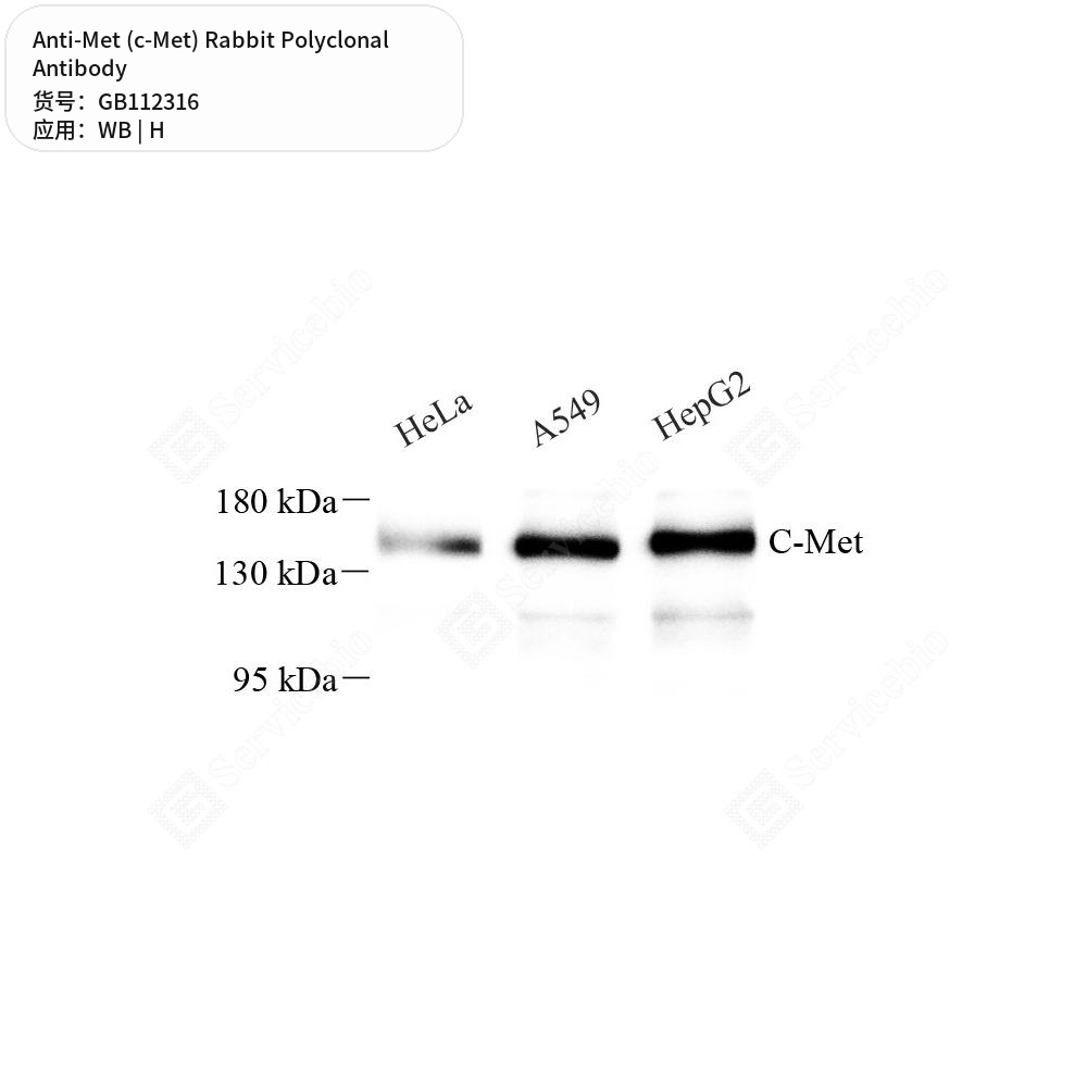 Антитела первичные, поликлональные кролика к Met (c-Met) человека, 100 мкл
