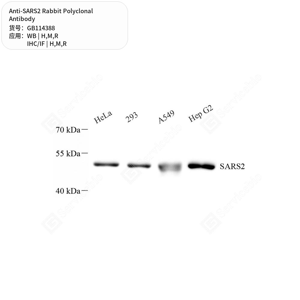 Антитела первичные, поликлональные кролика к SARS2 крысы, мыши, человека, 50 мкл