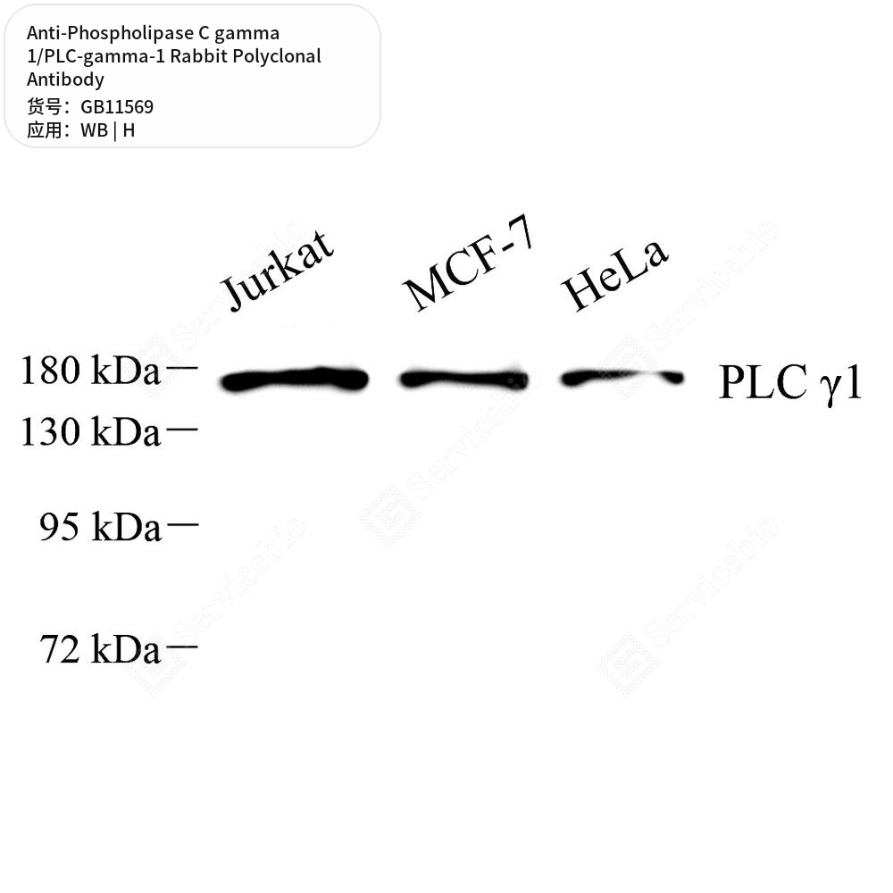 Антитела первичные, поликлональные кролика к Phospholipase C gamma 1/PLC-gamma-1 человека, 100 мкл