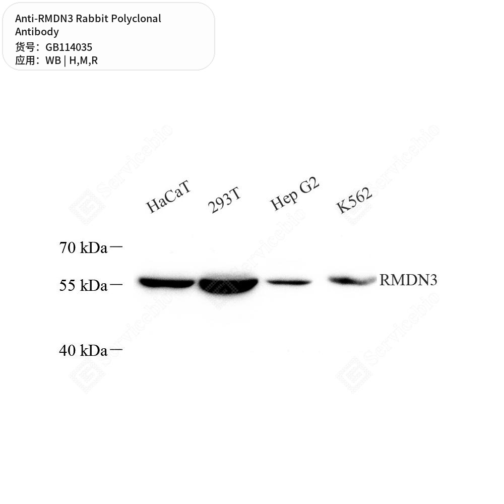 Антитела первичные, поликлональные кролика к RMDN3 крысы, мыши, человека, 100 мкл