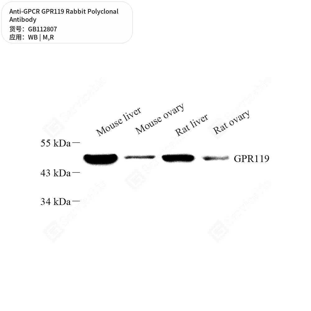 Антитела первичные, поликлональные кролика к GPCR GPR119 крысы, мыши, 100 мкл