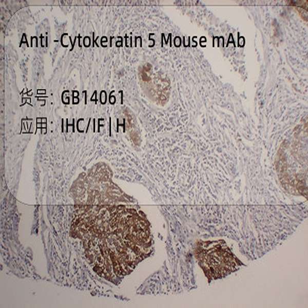 Антитела первичные, моноклональные, Cytokeratin 5, 50 мкл