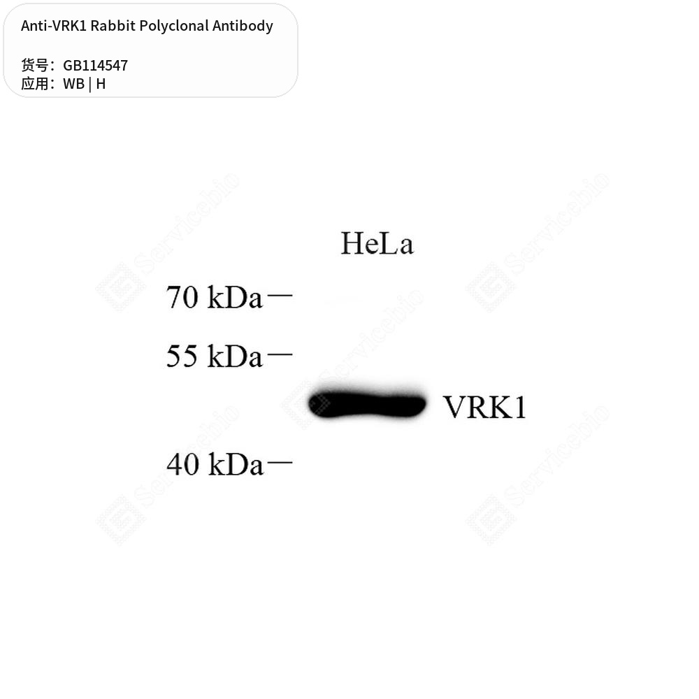 Антитела первичные, поликлональные кролика к VRK1 человека, 100 мкл