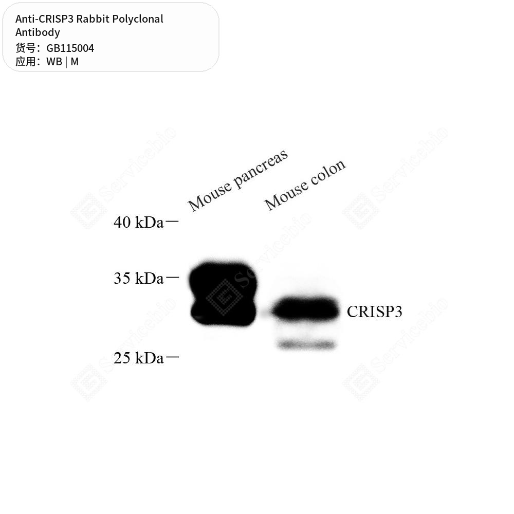 Антитела первичные, поликлональные кролика к CRISP3 мыши, 100 мкл