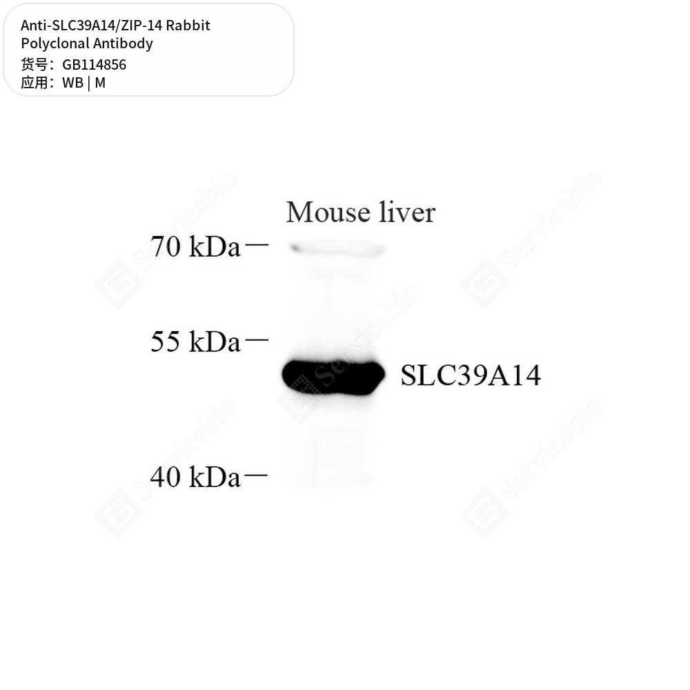 Антитела первичные, поликлональные кролика к SLC39A14/ZIP-14 мыши, 50 мкл